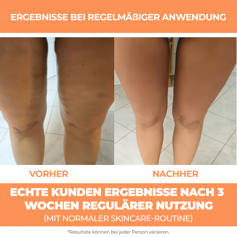 GoSculpedMe™ - Massage Roller